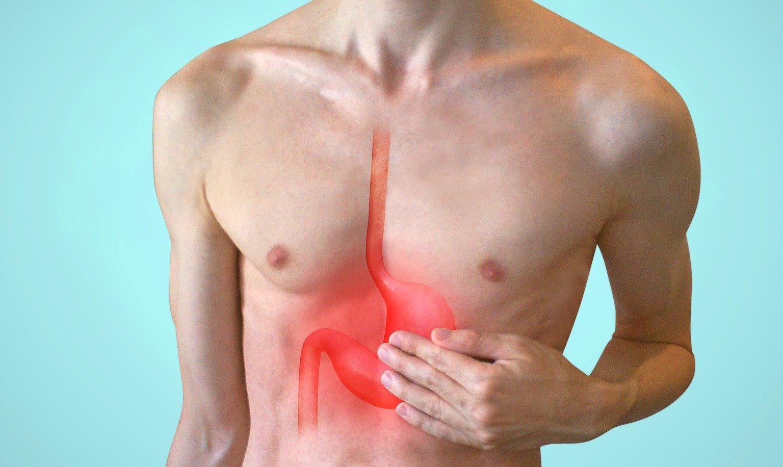 Gastric Surgery and Acid Reflux Bariatric Fusion